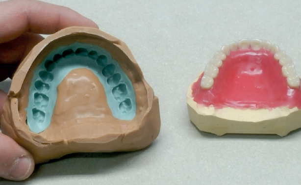 5) Controllare e rimuovere silicone in eccesso Image