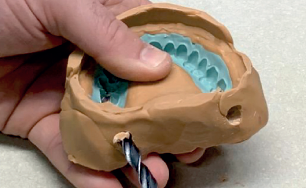 6) Fare dei buchi posteriormente con un alesatore da 8 mm Image